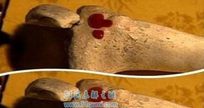 ​滴血认亲的本理是什么?滴血认亲有科学根据吗?