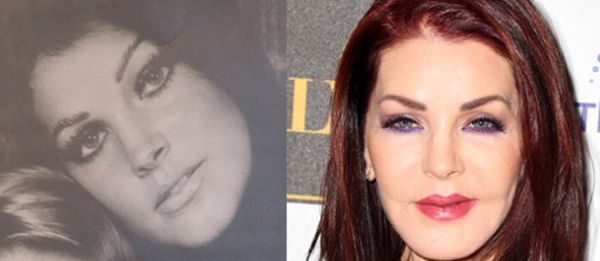 整容波折?整容变毁容的15个实在案例(附对于比图片)