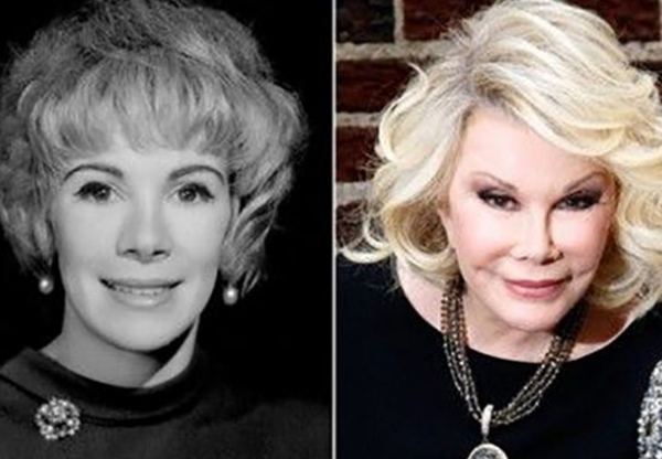 整容波折?整容变毁容的15个实在案例(附对于比图片)