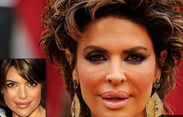 整容波折?整容变毁容的15个实在案例(附对于比图片)