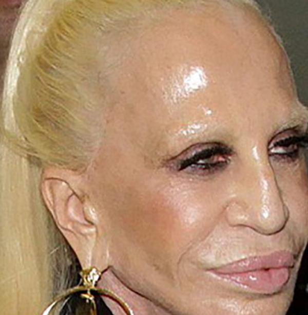 整容波折?整容变毁容的15个实在案例(附对于比图片)