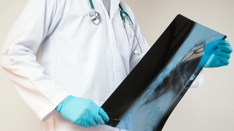 肺部CT需求暴增 检出率约10%-20%