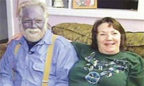 世界上实在存在的蓝脸人，如共蓝色皮肤的阿凡是达