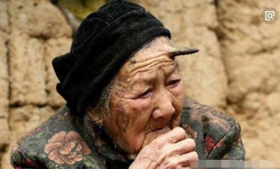 ​百岁老翁头上长“犄角”之谜，预见癌症病变_皮肤肿瘤
