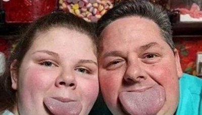 ​世界最宽舌头 美国父女发明了新的吉尼斯世界记录