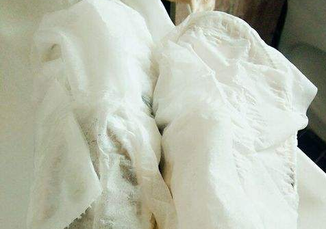 鞋边变黄了怎么洗白,鞋子白边发黄有什么办法变白图5