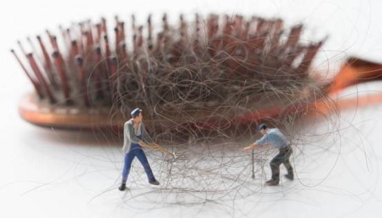 脱发的偏方秘方(脱发偏方大盘点)(5)