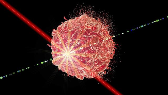 先天性脊髓栓系综合征严重不（新生儿的罕见病）(3)