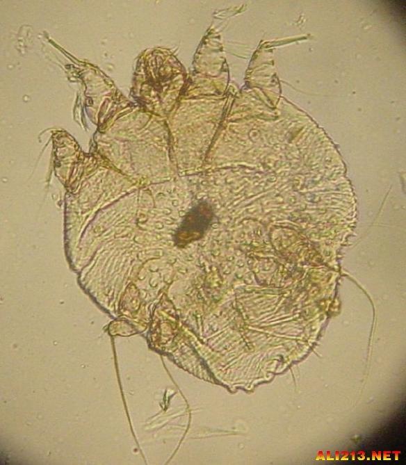 六种寄生虫多的食物（生活中最常见的26种恶心的寄生虫）(11)