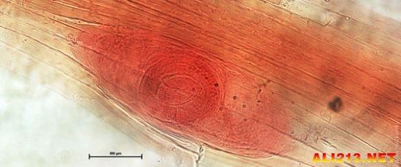 六种寄生虫多的食物（生活中最常见的26种恶心的寄生虫）(17)