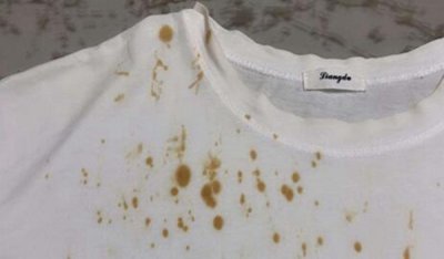 ​衣服上的油渍怎样去除小诀窍 多种办法去除固执油渍
