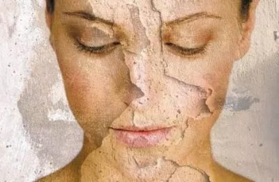 ​小腿皮肤像鱼鳞是的怎么回事(儿童小腿皮肤像鱼鳞)