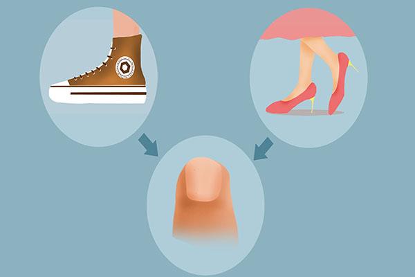 指甲变薄怎么养回来(指甲变薄是什么原因)