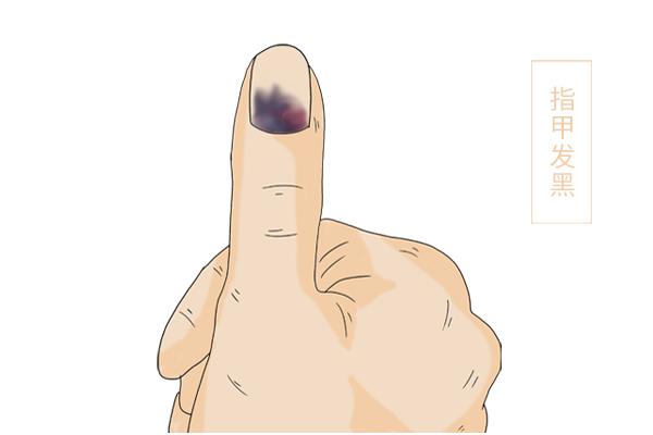 指甲变薄怎么养回来(指甲变薄是什么原因)