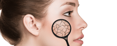 ​肌肤什么时候最缺水