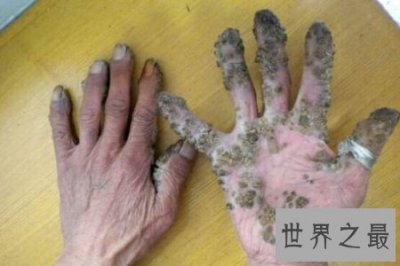 ​痋术是是一种巫术 也是一种邪术 据说它十分可怕