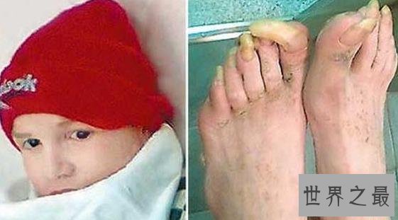 世界十大兽孩,被深山野兽养大的人类孩子