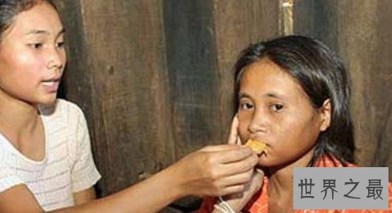 世界十大兽孩,被深山野兽养大的人类孩子