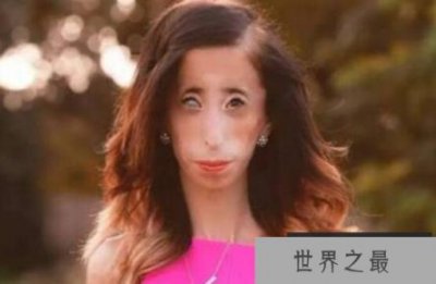 ​世界上最丑的女人,美国女人被称为骷髅女孩（胆小慎入！）