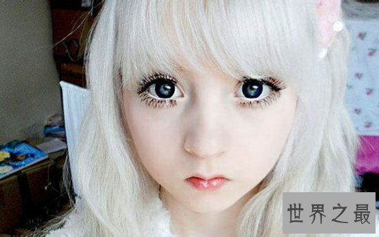 白化病萝莉,虽然不幸患病,却拥有着超人的乐观心态