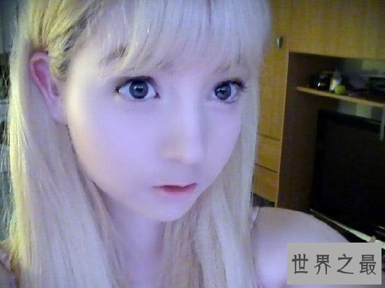 白化病萝莉,虽然不幸患病,却拥有着超人的乐观心态