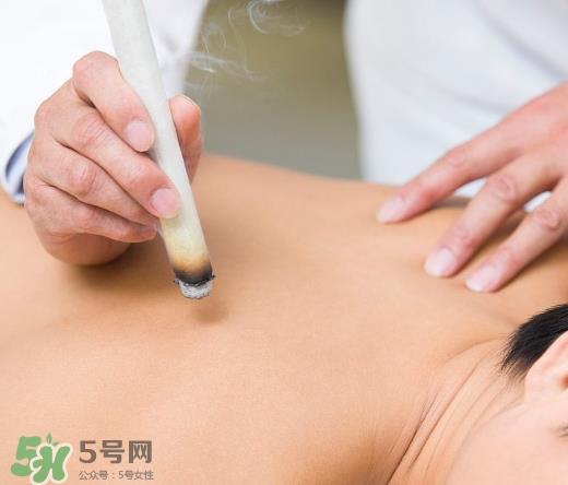 三伏贴和艾灸哪个好?三伏贴和艾灸区别 三伏贴和艾灸哪个好?三伏贴和艾灸区别