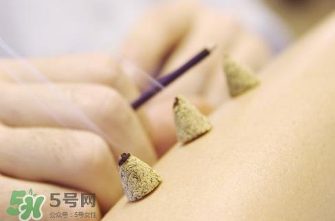 三伏贴和艾灸哪个好?三伏贴和艾灸区别 三伏贴和艾灸哪个好?三伏贴和艾灸区别