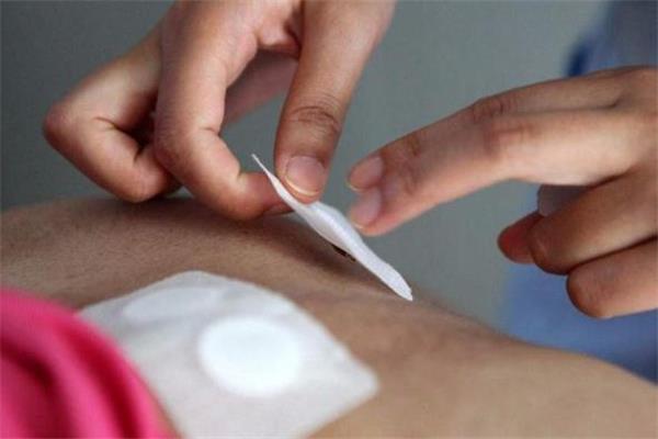 三伏贴一次贴几张 贴三伏贴要忌口多长时间 三伏贴一次贴几张 贴三伏贴要忌口多长时间