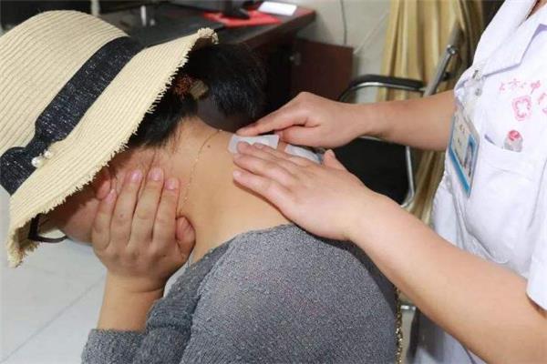 三伏贴一次贴几张 贴三伏贴要忌口多长时间 三伏贴一次贴几张 贴三伏贴要忌口多长时间