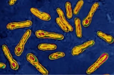 ​生活中常见的十种致命毒素