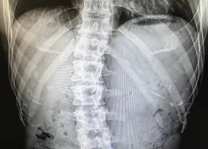 金钟国健身二十年,综艺中常以健壮示人,其实那都是假象