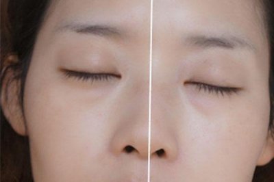 ​象牙白是什么颜色 象牙白是黄调还是粉调