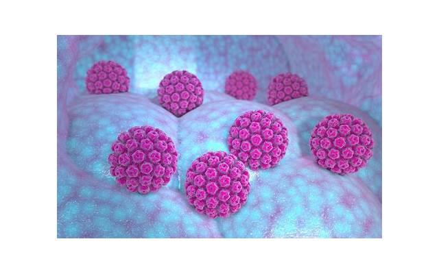 老婆感染hpv是出轨了么，老婆感染HPV，是否暗示出轨？