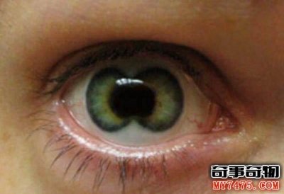​历史上双瞳的人有哪些？传说的帝王之才