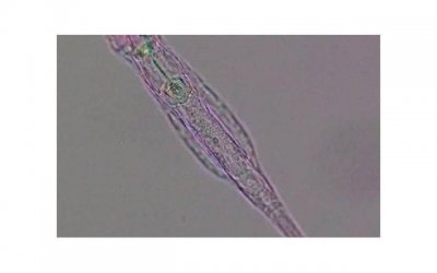 ​从绝望中寻找希望文