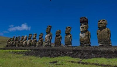 ​人去世之后为什么要堵住肛门,人去世后为什么大便