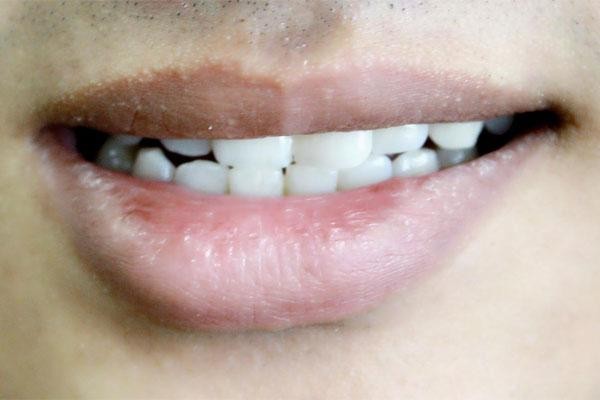 睡觉时总会磨牙是什么原因（为什么人在睡觉时会磨牙）(2)