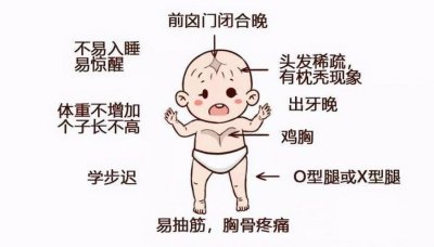 ​宝宝有这三个症状是佝偻病（佝偻病宝宝会有这6种明显症状）