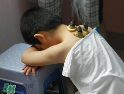 ​三伏灸什么时候做最好？三伏灸可以晚上做吗？