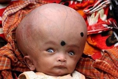 ​孩子脑袋大是什么原因(头大的孩子是什么原因)