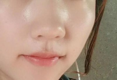 ​鼻子很容易出油(鼻子很容易出油怎么办)