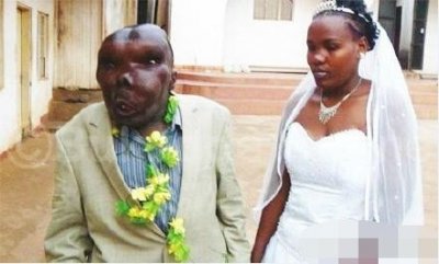 ​世界上第一丑的男人（世界上最丑的男人却成人生赢家）