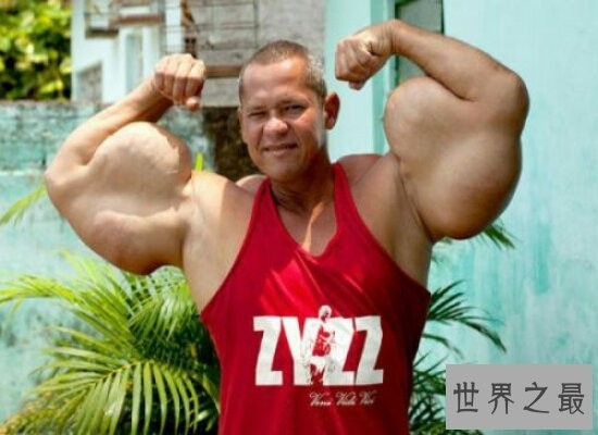 世界史上最强肌肉男  肌肉比头都要大靠着注射填充剂维持