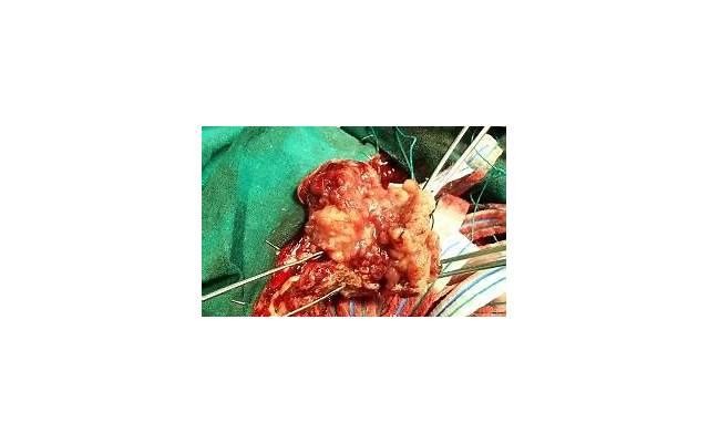 气球怎么布置好看（生日气球怎么布置好看）