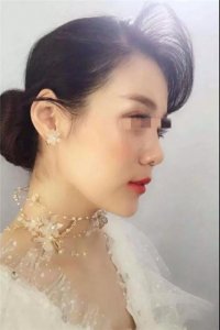 ​也许是冰冻的野格太烈，上头的记不起那晚发生的事