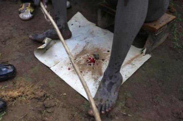 非洲割礼是怎么回事（非洲割礼的解释）