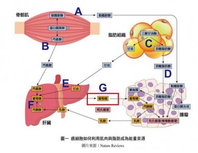 ​我特别嗜睡是什么原因 12症状恐是恶病质作祟