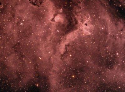 ​北京茗视光眼科，全飞秒近视手术总体体会分享