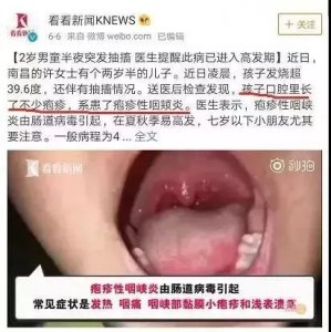 ​咽颊炎有什么症状如何治疗 近期疱疹性咽峡炎高发！宝妈宝爸看好这个提醒