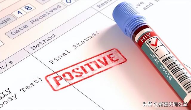 以色列治愈艾滋病最新研究进展（以色列研究人员称:艾滋病可治愈）(1)